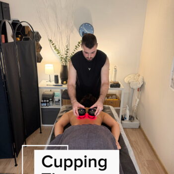 Cupping therapy in Sofia